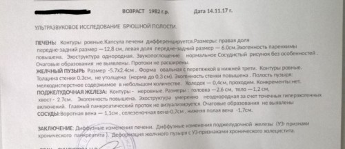 Узи ноябрь 2017.JPG
