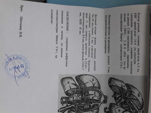 Провели обследование еще раз, результаты таковы:<br />Днк вируса гепатита ''В&quot; 2.9 × 10^4 копий/мл, позвонили в лабораторию сказали коэффициент 4.5, получается 6.4 × 10^3 ме/мл. <br />АЛТ 55,22 ме/мл. <br />Элатометрию печени прилагаю. Пока ПВТ не начал, а врач назначил  :unknw: